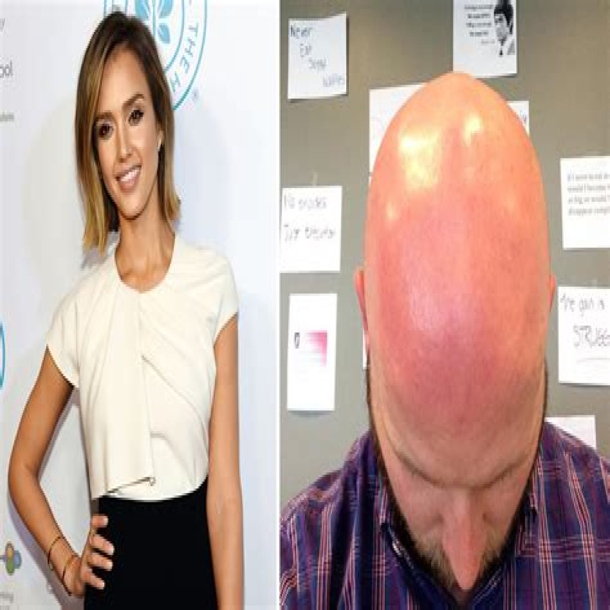 People who use Jessica Alba’s Honest sunscreen are posting sunburn photos
