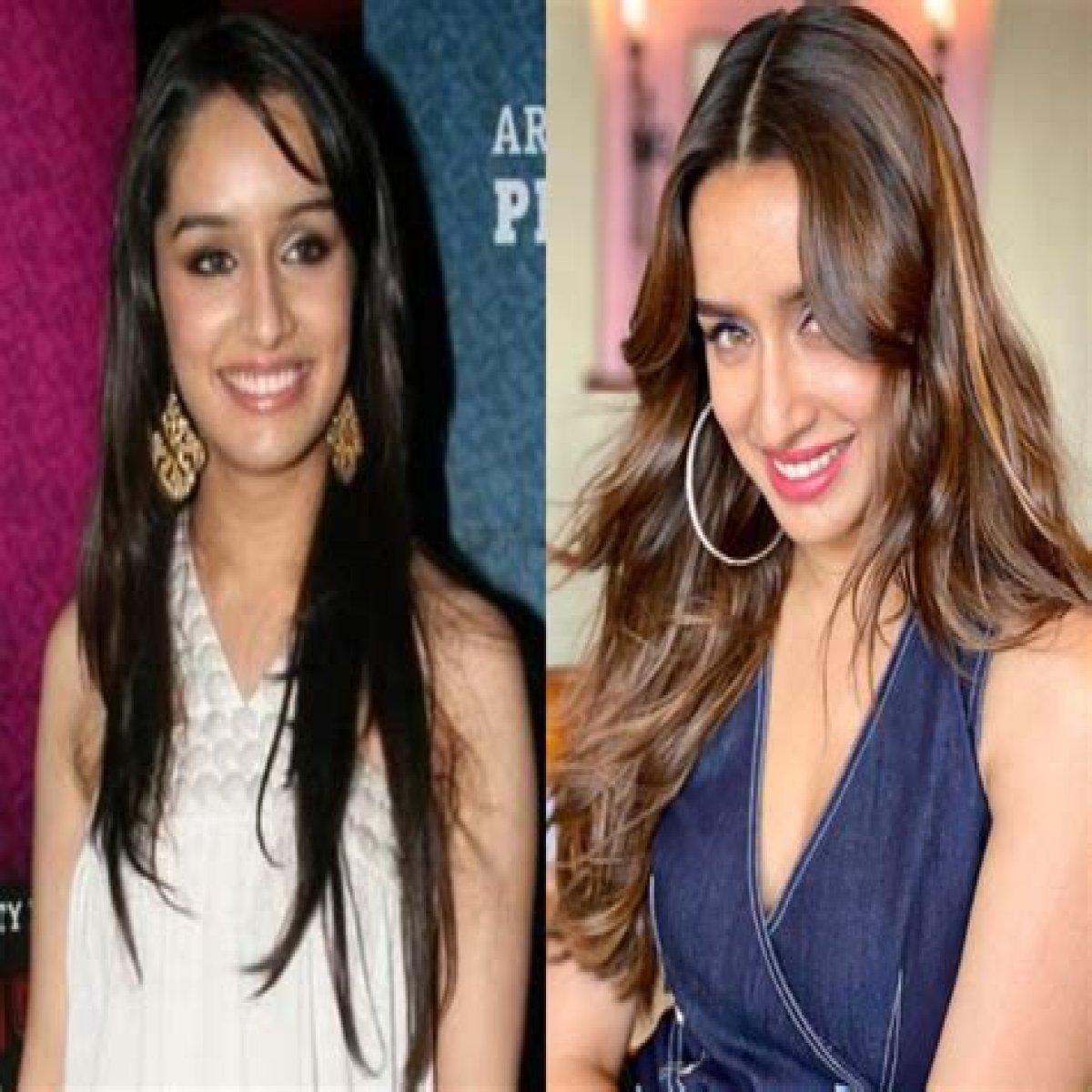 Shraddha Kapoor Plastic Surgery Before and After